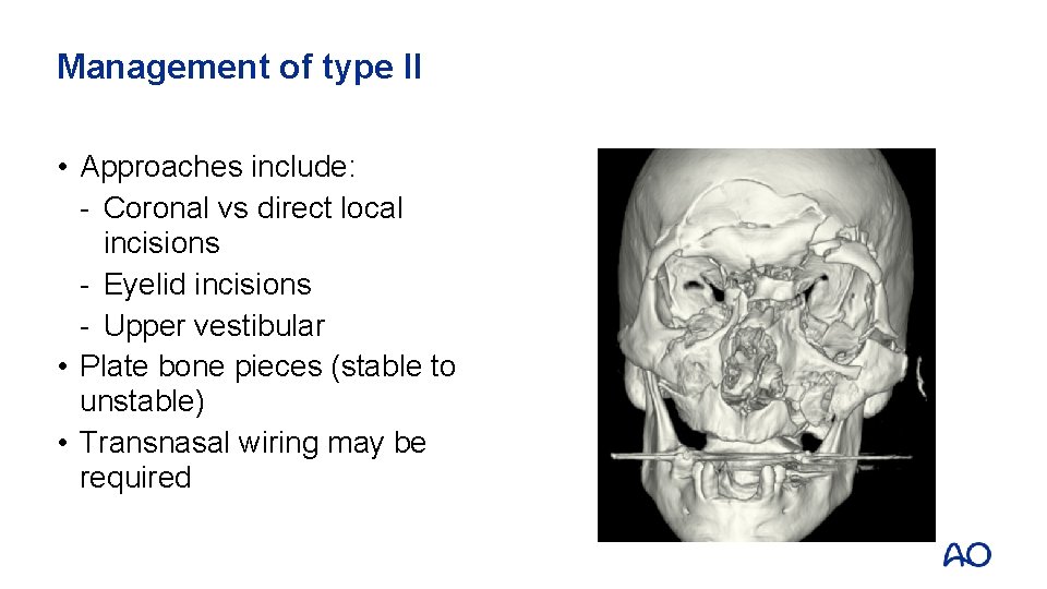 Management of type II • Approaches include: - Coronal vs direct local incisions -