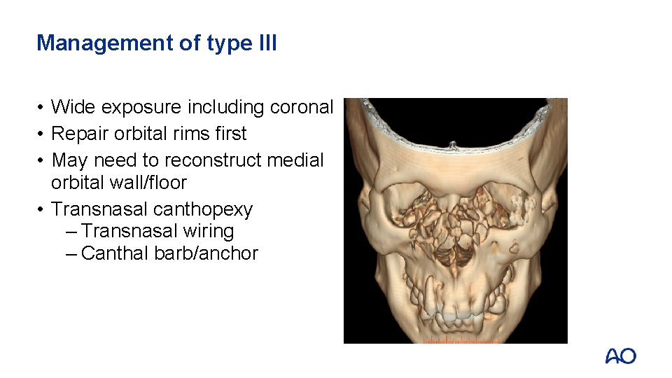 Management of type III • Wide exposure including coronal • Repair orbital rims first