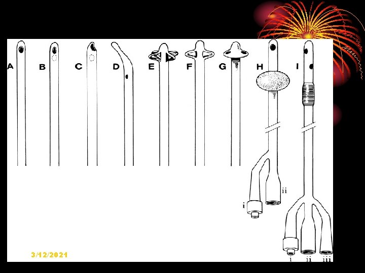 Tipos de Sondas. Nelaton. Tieman. Foley. Descripción. Indicaciones. Esterilización. Lubricación. 3/12/2021 