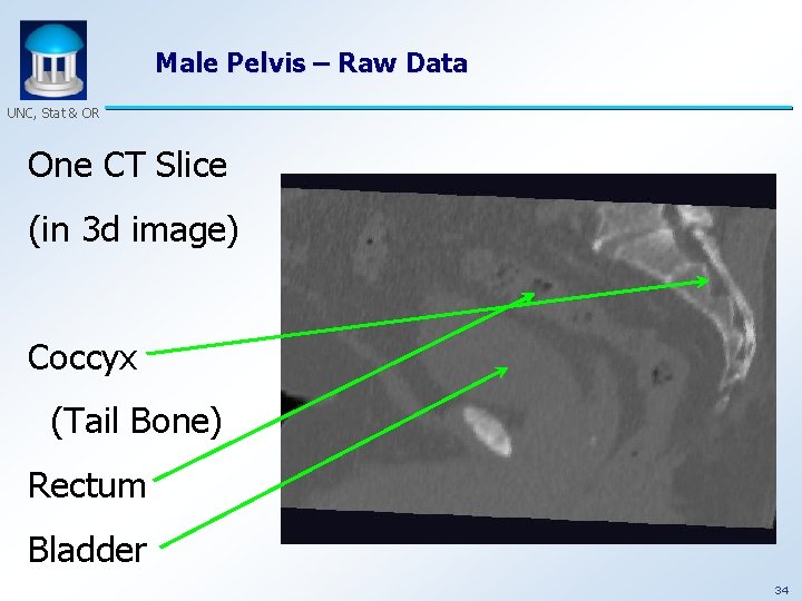 Male Pelvis – Raw Data UNC, Stat & OR One CT Slice (in 3