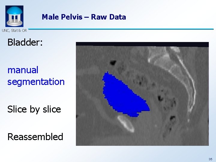 Male Pelvis – Raw Data UNC, Stat & OR Bladder: manual segmentation Slice by
