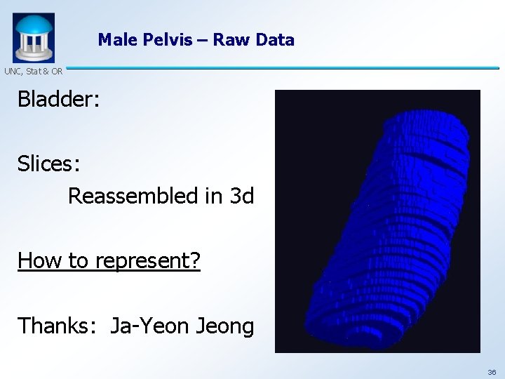 Male Pelvis – Raw Data UNC, Stat & OR Bladder: Slices: Reassembled in 3