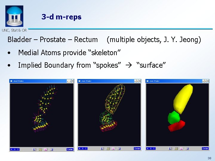 3 -d m-reps UNC, Stat & OR Bladder – Prostate – Rectum (multiple objects,