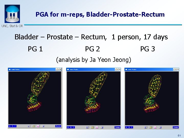 PGA for m-reps, Bladder-Prostate-Rectum UNC, Stat & OR Bladder – Prostate – Rectum, 1