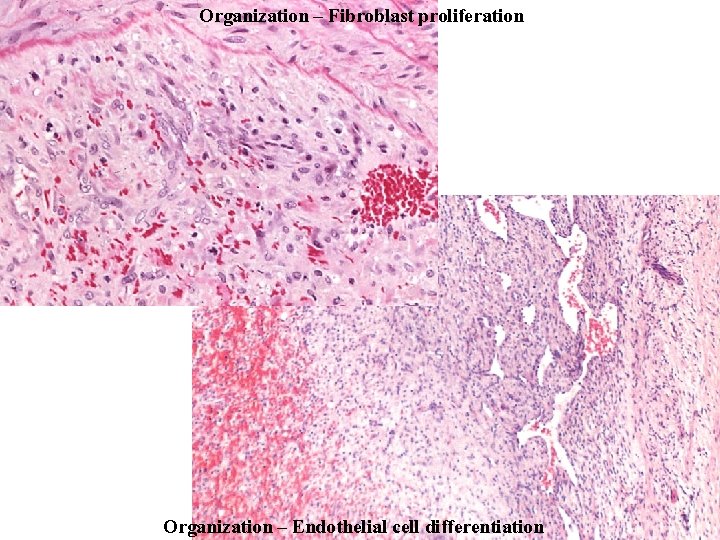 Organization – Fibroblast proliferation Organization – Endothelial cell differentiation 