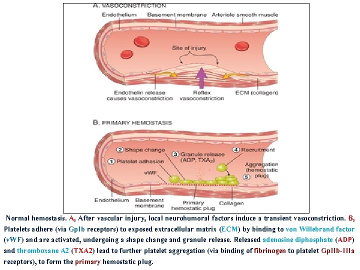 Normal hemostasis. A, After vascular injury, local neurohumoral factors induce a transient vasoconstriction. B,