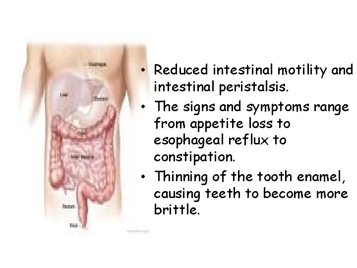  • Reduced intestinal motility and intestinal peristalsis. • The signs and symptoms range