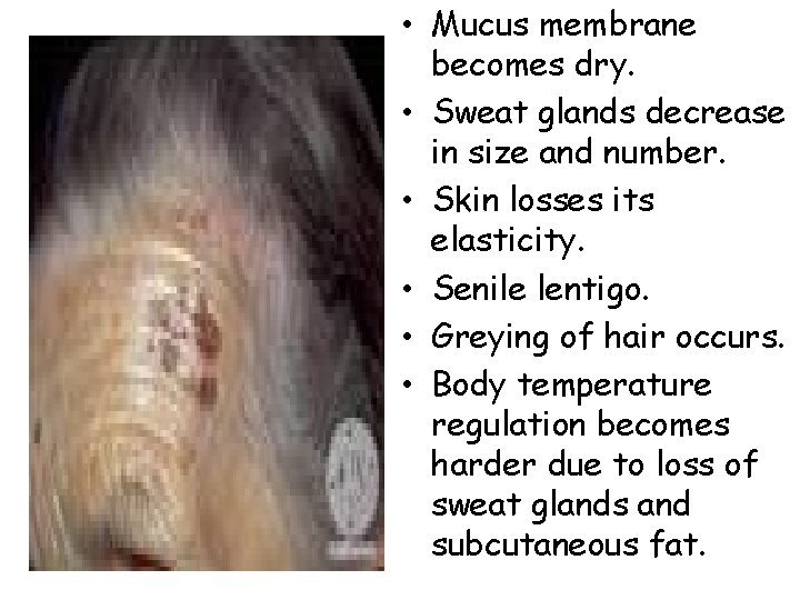  • Mucus membrane becomes dry. • Sweat glands decrease in size and number.