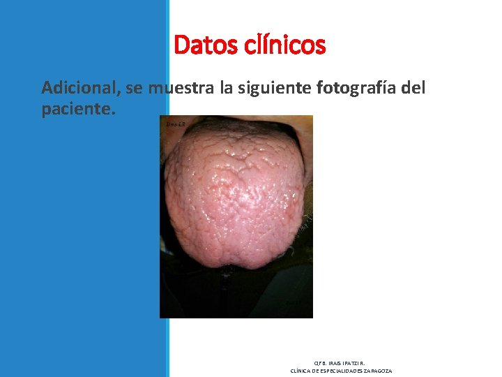 Datos clínicos Adicional, se muestra la siguiente fotografía del paciente. QFB. IRAIS IPATZI R.