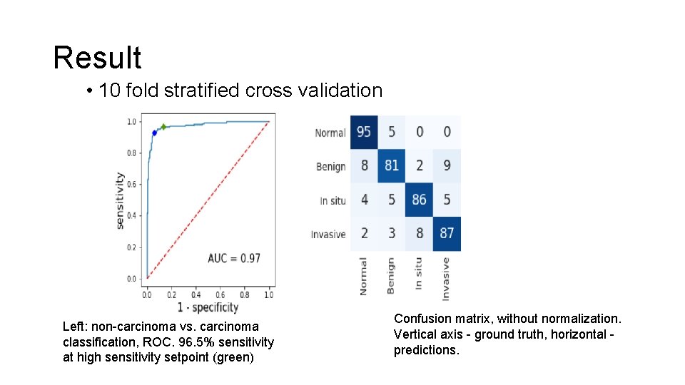 Result • 10 fold stratified cross validation Left: non-carcinoma vs. carcinoma classification, ROC. 96.