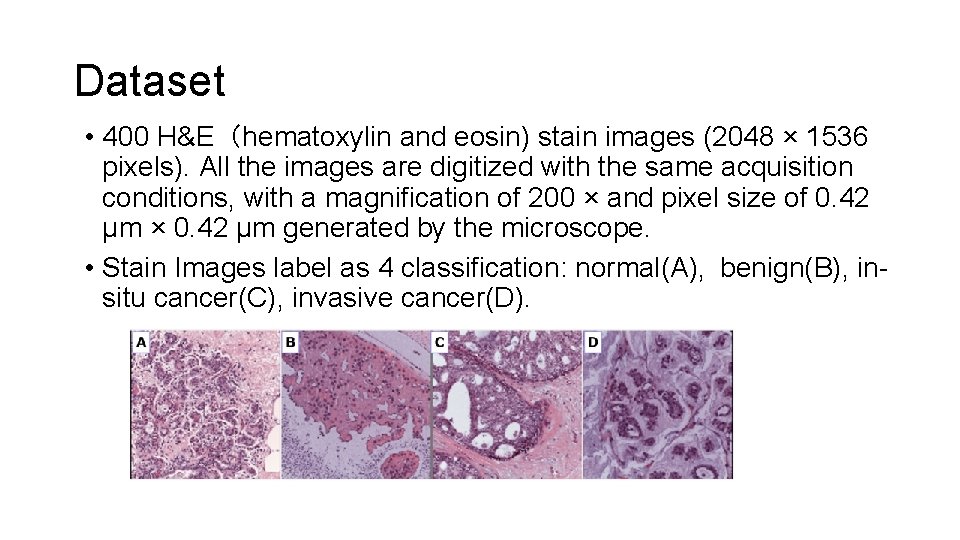Dataset • 400 H&E（hematoxylin and eosin) stain images (2048 × 1536 pixels). All the