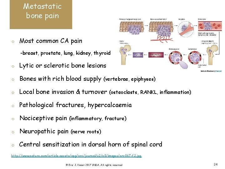 Metastatic bone pain o Most common CA pain -breast, prostate, lung, kidney, thyroid o