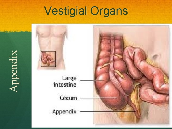 Appendix Vestigial Organs 