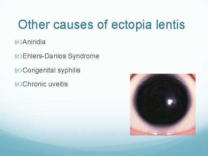 Other causes of ectopia lentis Aniridia Ehlers-Danlos Syndrome Congenital syphilis Chronic uveitis 