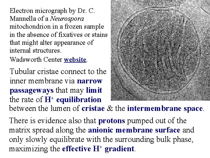 Electron micrograph by Dr. C. Mannella of a Neurospora mitochondrion in a frozen sample