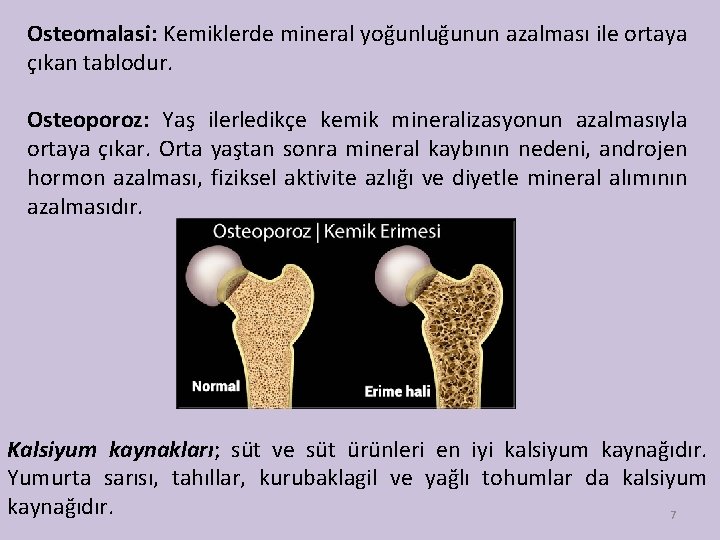 Osteomalasi: Kemiklerde mineral yoğunluğunun azalması ile ortaya çıkan tablodur. Osteoporoz: Yaş ilerledikçe kemik mineralizasyonun