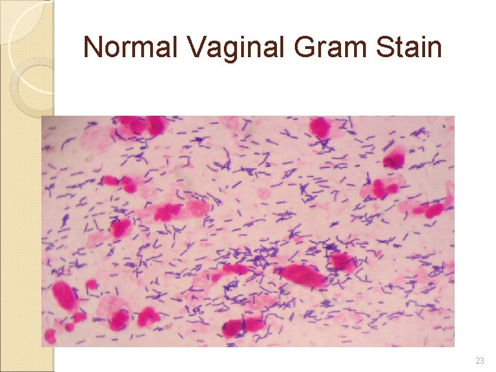 Normal Vaginal Gram Stain 23 