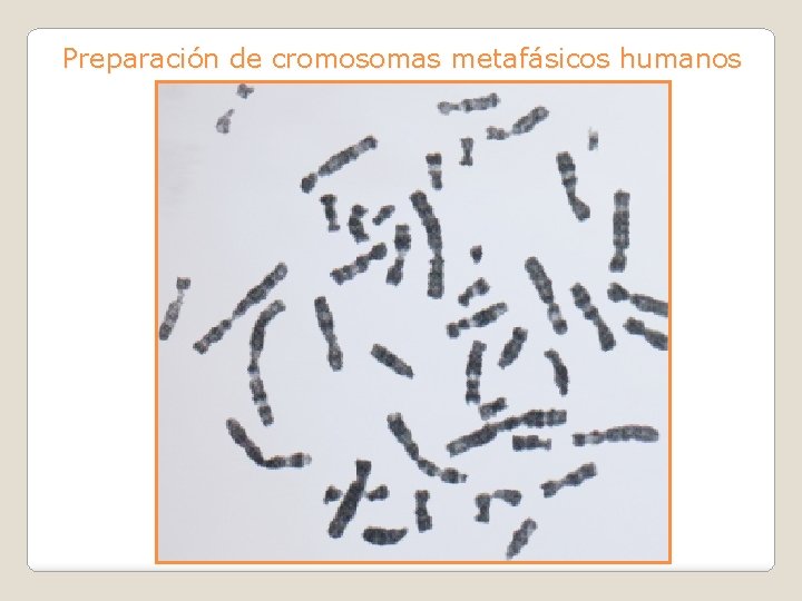 Preparación de cromosomas metafásicos humanos 