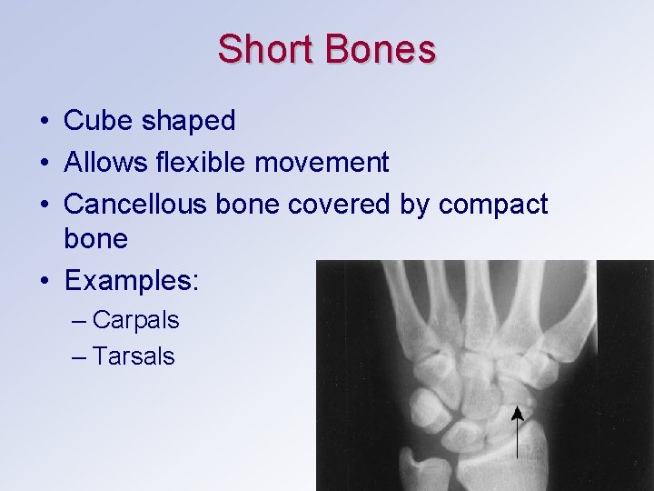 Short Bones • Cube shaped • Allows flexible movement • Cancellous bone covered by