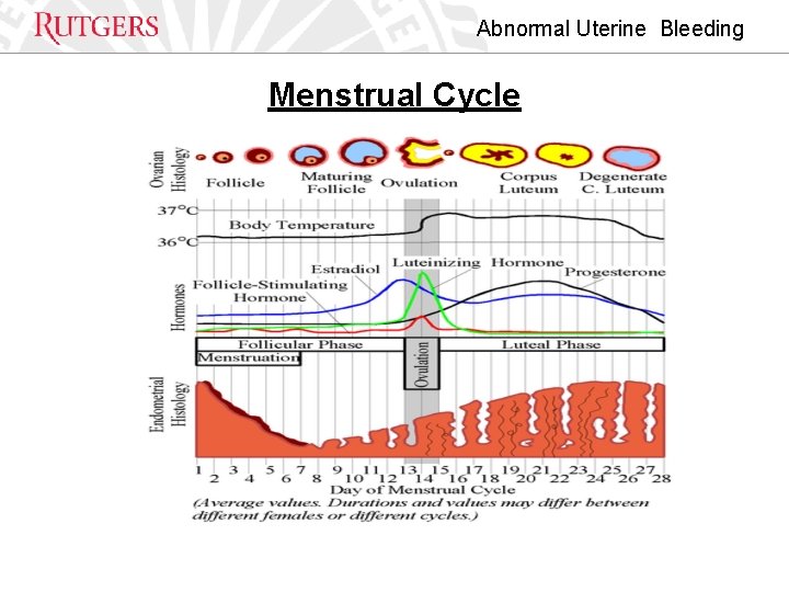 Abnormal Uterine Bleeding Menstrual Cycle 