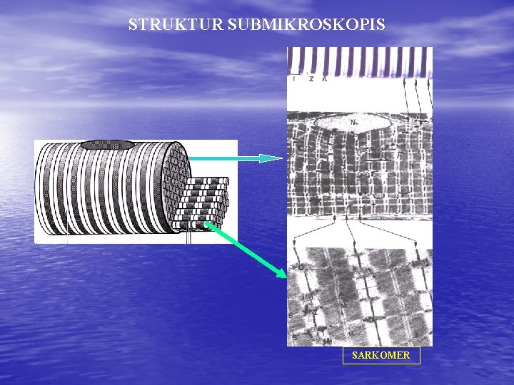 STRUKTUR SUBMIKROSKOPIS SARKOMER 