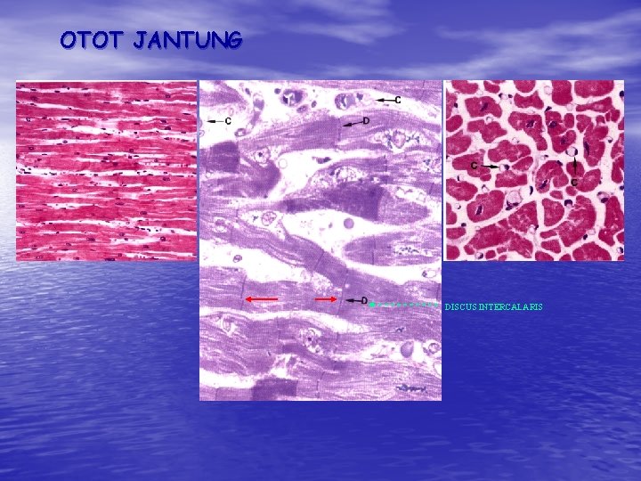 OTOT JANTUNG DISCUS INTERCALARIS OTOT JANTUNG DISCUS INTERCALARIS