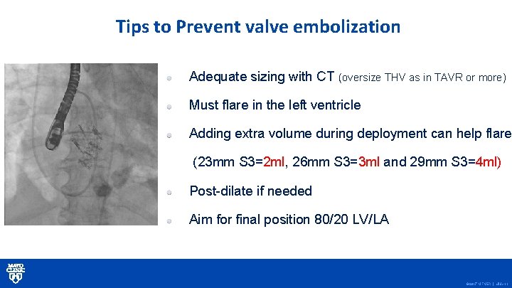 Tips to Prevent valve embolization Adequate sizing with CT (oversize THV as in TAVR