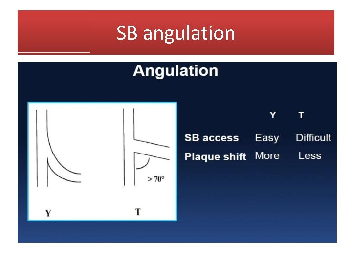 SB angulation 