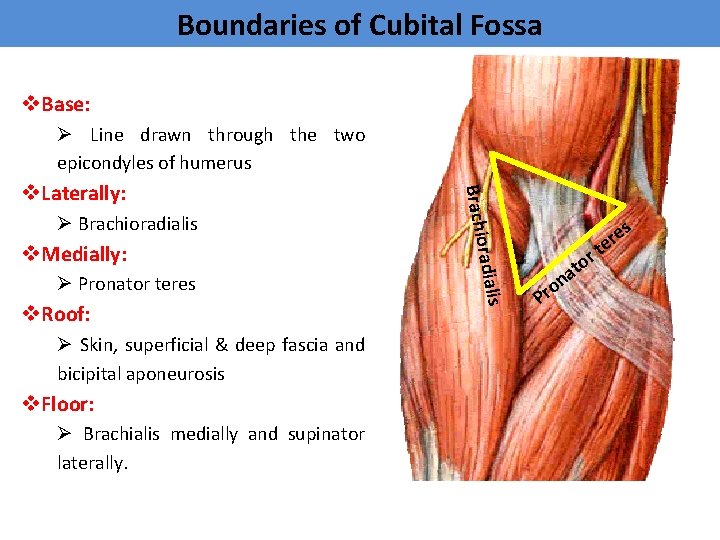 Boundaries of Cubital Fossa v. Base: Ø Line drawn through the two epicondyles of