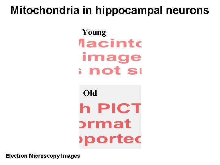 Mitochondria in hippocampal neurons Young Old Electron Microscopy Images 