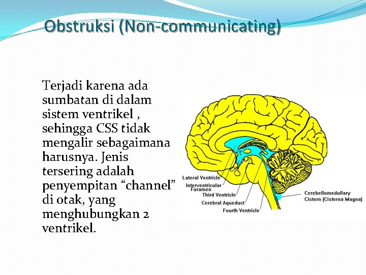 Obstruksi (Non-communicating) Terjadi karena ada sumbatan di dalam sistem ventrikel , sehingga CSS tidak