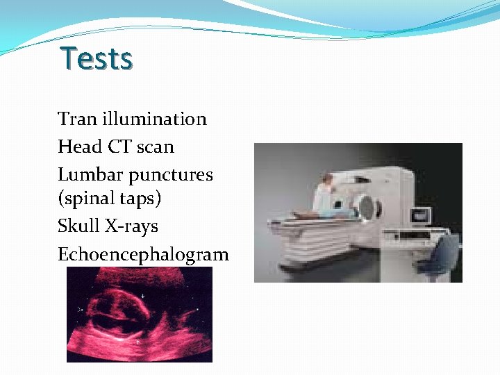 Tests Tran illumination Head CT scan Lumbar punctures (spinal taps) Skull X-rays Echoencephalogram 