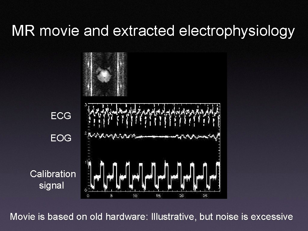 MR movie and extracted electrophysiology ECG EOG Calibration signal Movie is based on old