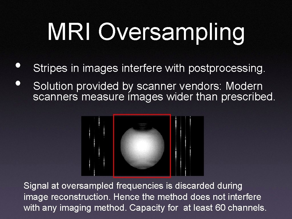 MRI Oversampling • • Stripes in images interfere with postprocessing. Solution provided by scanner