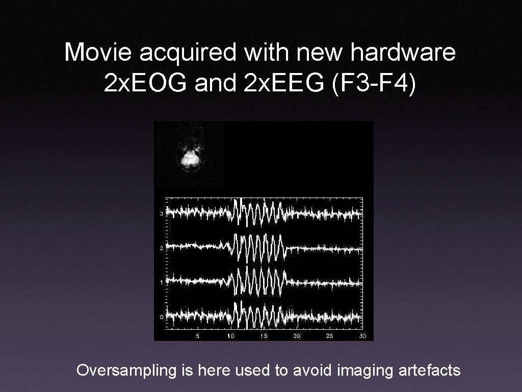 Movie acquired with new hardware 2 x. EOG and 2 x. EEG (F 3