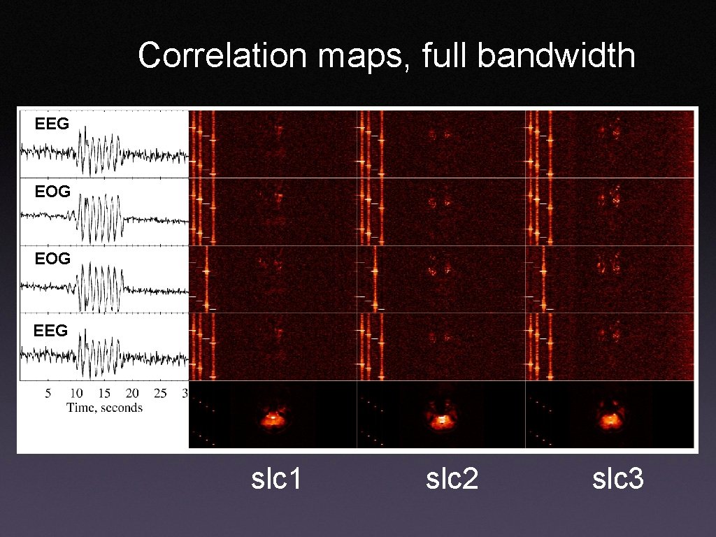 Correlation maps, full bandwidth EEG EOG EEG slc 1 slc 2 slc 3 