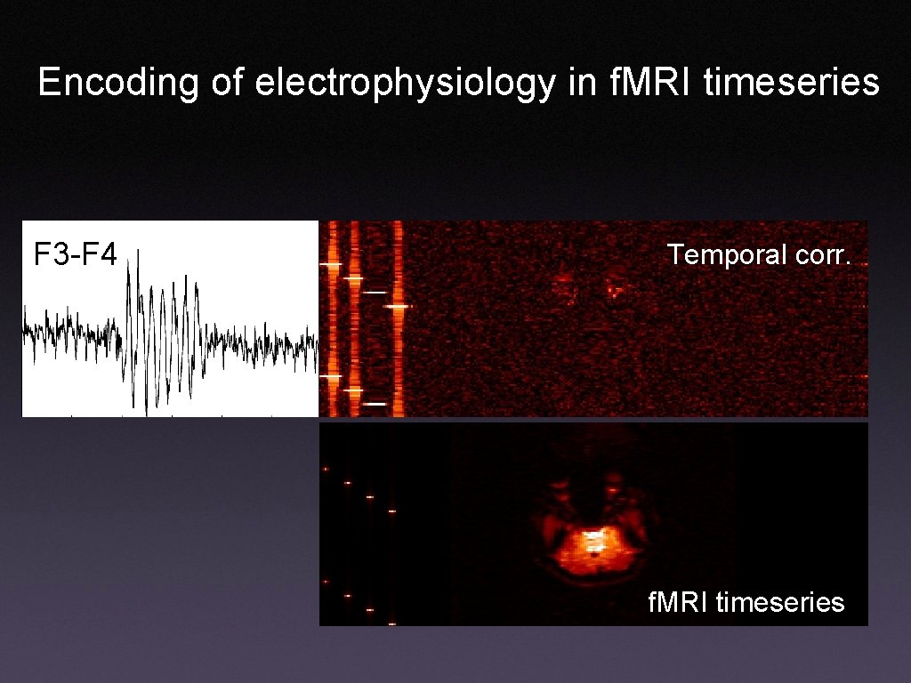 Encoding of electrophysiology in f. MRI timeseries F 3 -F 4 Temporal corr. f.