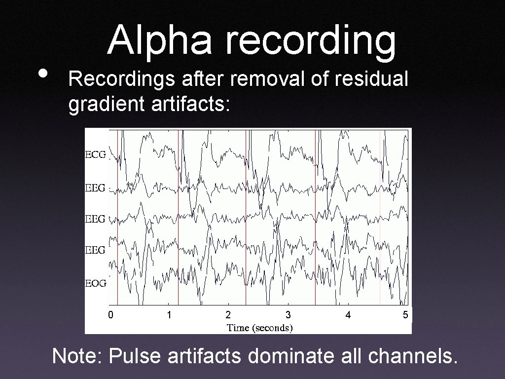  • Alpha recording Recordings after removal of residual gradient artifacts: 0 1 2