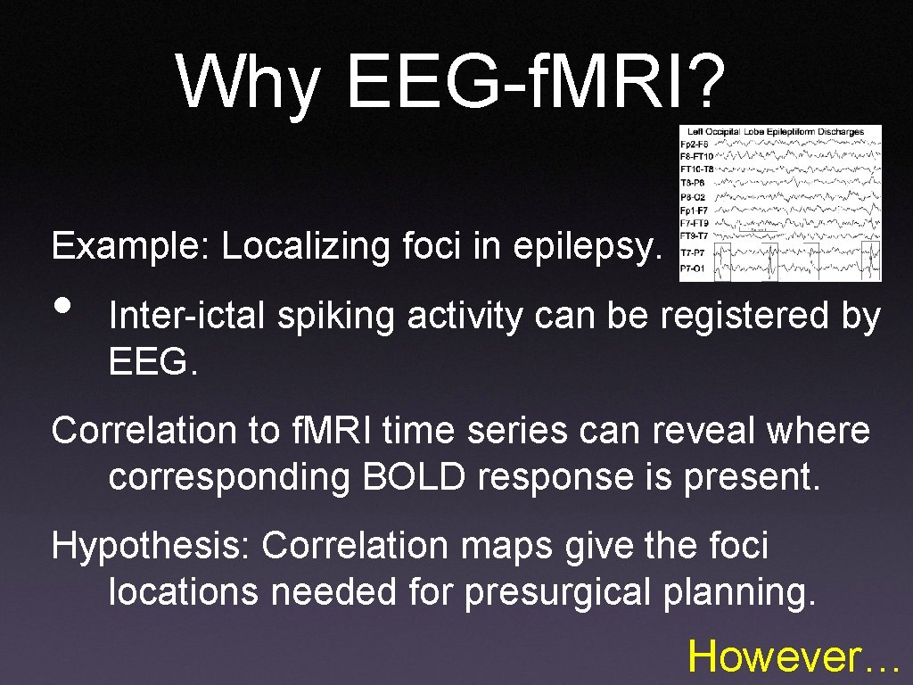 Why EEG-f. MRI? Example: Localizing foci in epilepsy. • Inter-ictal spiking activity can be