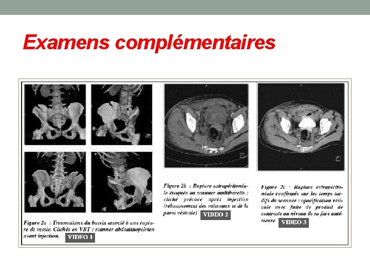 Examens complémentaires 