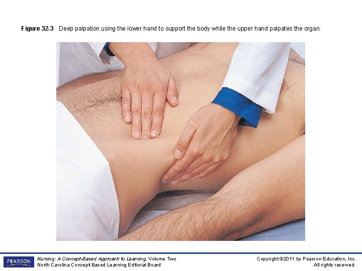Figure 32 -3 Deep palpation using the lower hand to support the body while