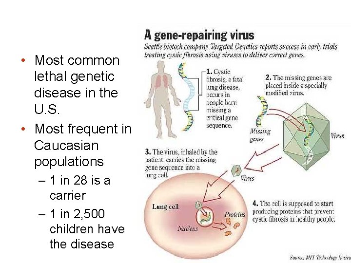  • Most common lethal genetic disease in the U. S. • Most frequent