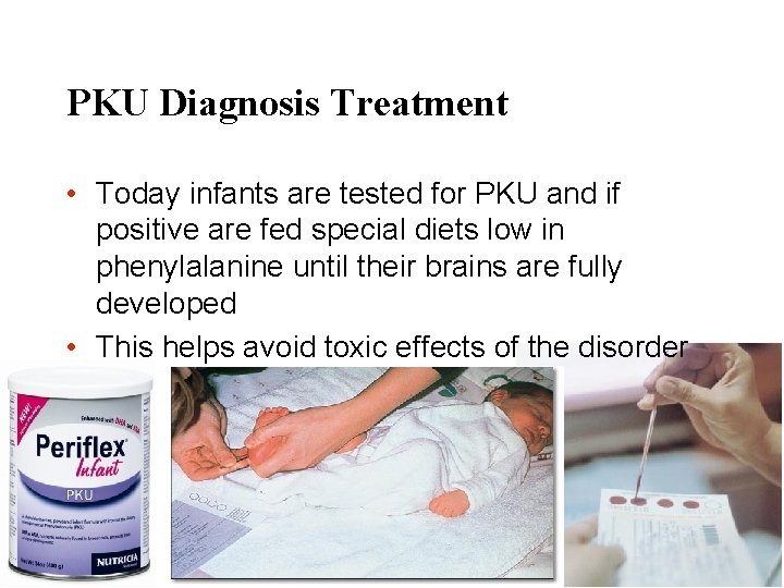 PKU Diagnosis Treatment • Today infants are tested for PKU and if positive are