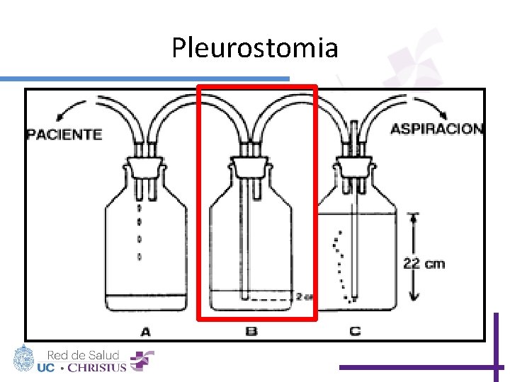 Pleurostomia 