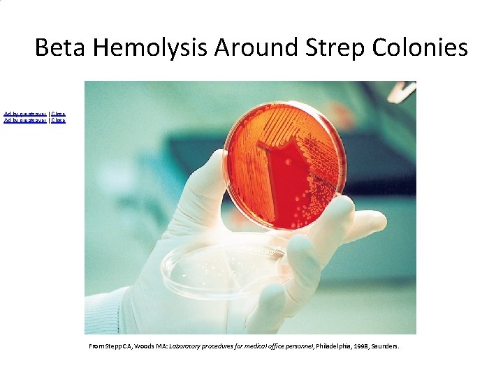 Beta Hemolysis Around Strep Colonies Ad by greatsaver | Close From Stepp CA, Woods