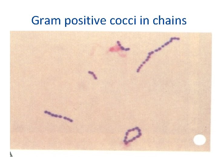 Gram positive cocci in chains 
