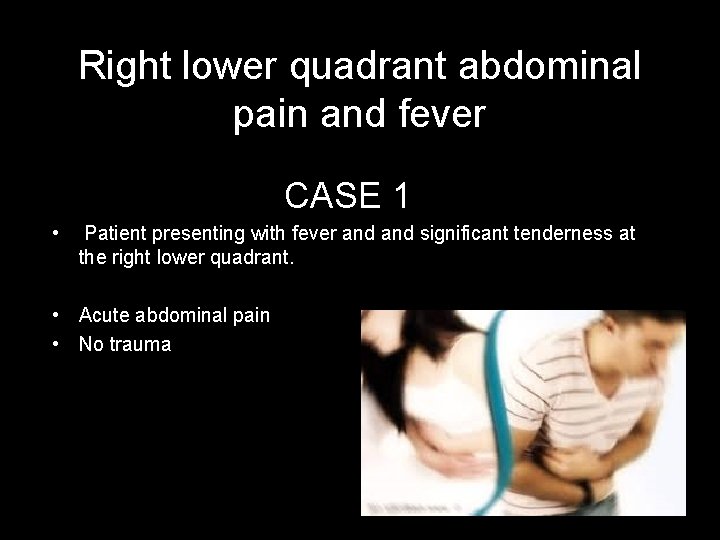 Right lower quadrant abdominal pain and fever CASE 1 • Patient presenting with fever