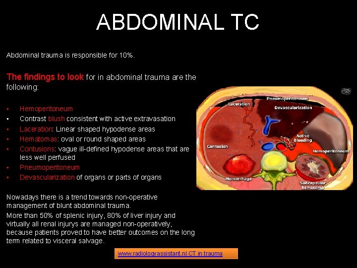 ABDOMINAL TC Abdominal trauma is responsible for 10%. The findings to look for in