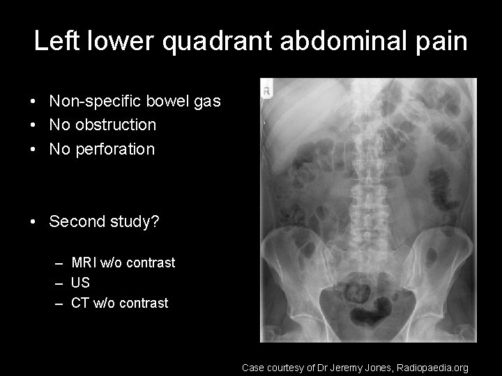 Left lower quadrant abdominal pain • Non-specific bowel gas • No obstruction • No