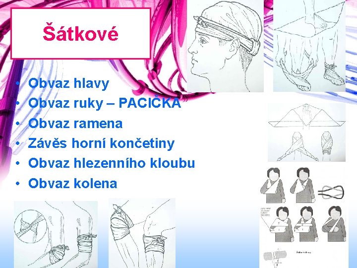 Šátkové • • • Obvaz hlavy Obvaz ruky – PACIČKA Obvaz ramena Závěs horní